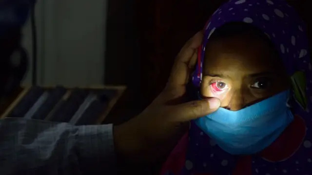 سیلاب کے باعث بیماریاں  بڑھنے لگی،ملاکنڈ میں  آشوب چشم کی وبا، ہزاروں متاثر